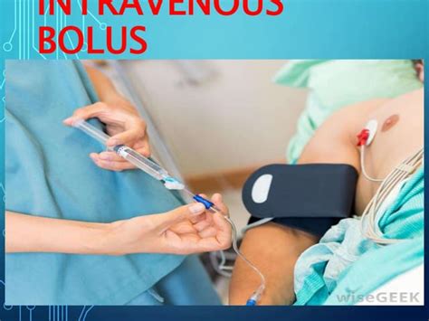 Intravenous Bolus Procedure | PPT