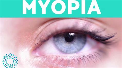 MYOPIA - Causes And Symptoms - YouTube