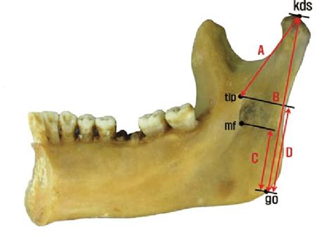 Measurements of the location of the mandibular foramen | Download Scientific Diagram