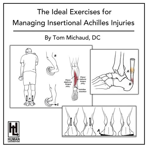 The Ideal Exercises for Managing Insertional Achilles Injuries - Human Locomotion