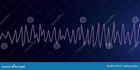 Electrocardiogram ECG Displaying Torsades De Pointes Rhythm, 3D Illustration Stock Illustration ...