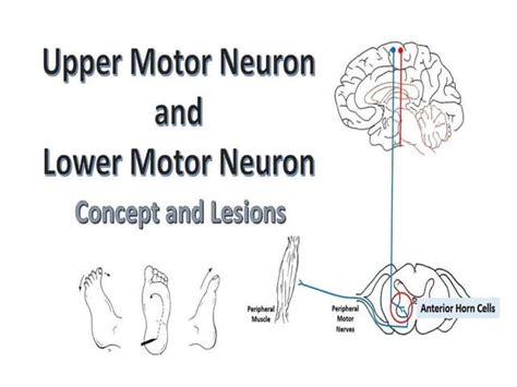 Upper & Lower Motor Neuron Lesions.pptx | Free Download