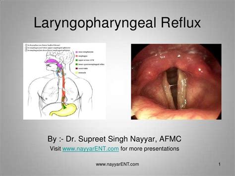 LPR Laryngopharyngeal Reflux | Familie