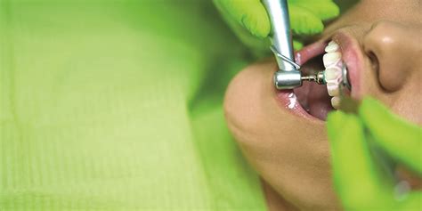 Scaling & Polishing | Life Dental Care