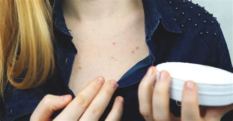 Chest Acne: Causes and Treatments, And How it Differs From Facial Acne