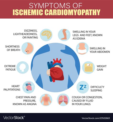 Symptoms ischemic cardiomyopathy detailed Vector Image