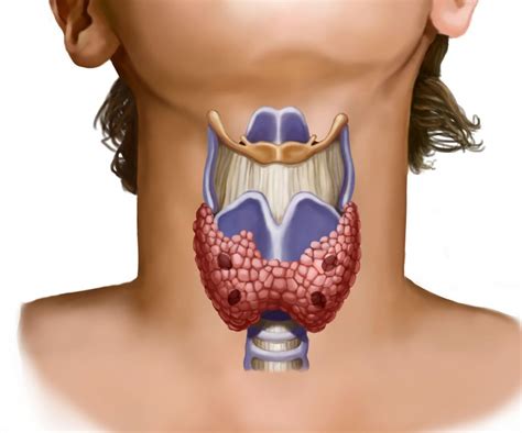 Thyroid nodules diagnosis. Thyroid nodules treatment. Must know