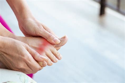 Steps to Take During a Gout Flare-Up: Great Lakes Foot and Ankle Institute: Podiatrists