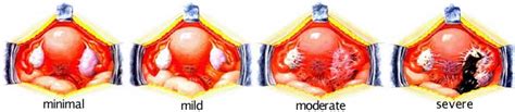 St. Mother Hospital | Infertility Clinic, IVF Clinic