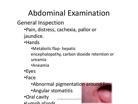 abdominal examination