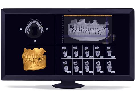 Cone beam computed tomography CBCT dental x-ray digital te… | Flickr