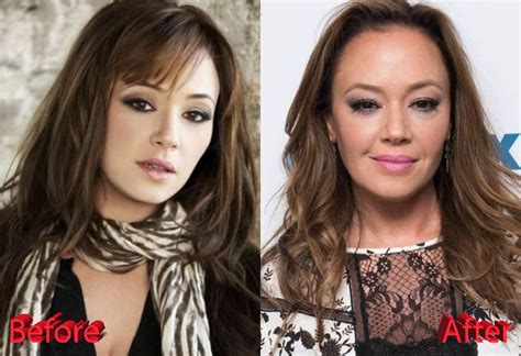 Leah Remini Plastic Surgery: Forever Young Leah