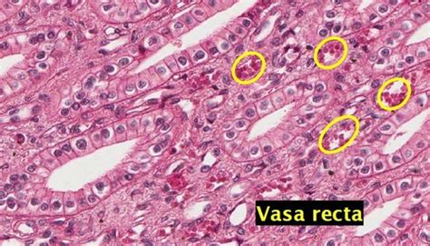 Vasa Recta Histology