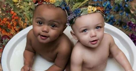 These Twins With Different Skin Colors Are '1 In A Million' - Here They Are All Grown Up | Skin ...