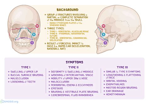 Le Fort Fracture: What Is It, Diagnosis, and Treatment | Osmosis