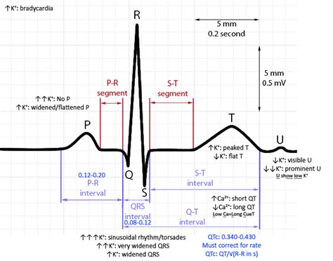 EKG intervals