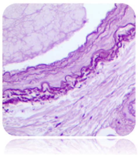 Orcein Solution Histology Stain, 1000mL