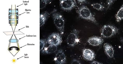 Dark Field Microscopy: What it is And How it Works » Microscope Club