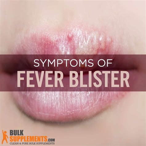 Fever Blisters: Causes, Symptoms & Treatments | BulkSupplements