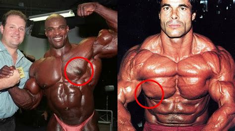 3 bodybuilders with gyno who won Mr Olympia - YouTube