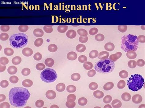 PPT - Non Malignant WBC - Disorders PowerPoint Presentation, free download - ID:1427355