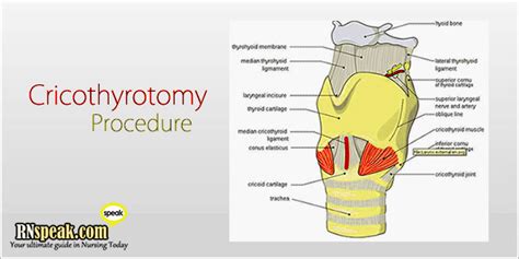 Cricothyrotomy Procedure