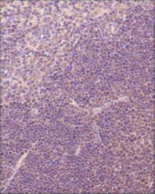 TRIF/TICAM1 Antibody - BSA Free (NB120-13810): Novus Biologicals