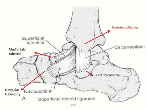 ANKLE FRACTURES