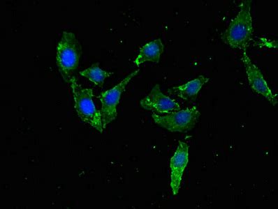 anti-Homo sapiens (Human) TFEB Antibody raised in Rabbit - Cusabio