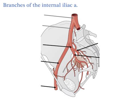 Branches of Internal Iliac Artery Diagram | Quizlet