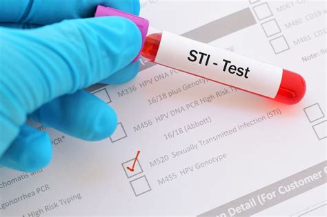 STI Clinic | Marin Community Clinic | STD Screening, Birth Control