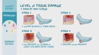 Eschar: What It Is, Causes, Treatment, and More | Osmosis