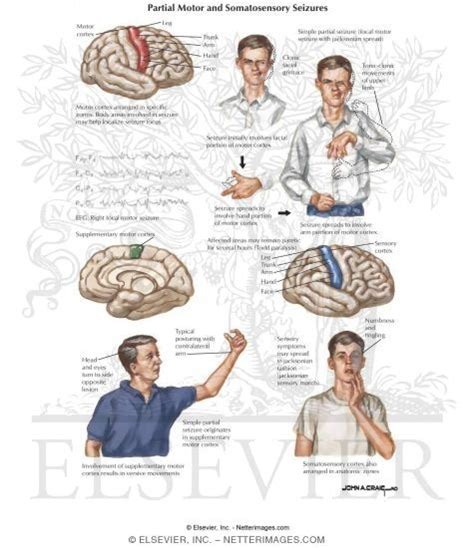 Partial Motor and Somatosensory Seizures