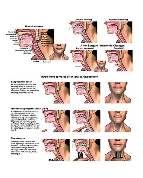 Buy YNB Electronic Larynx Anatomy Poster Human Larynx Scientific Wall ...