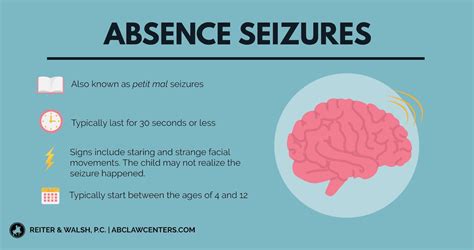 Types of seizures and durations - forradar