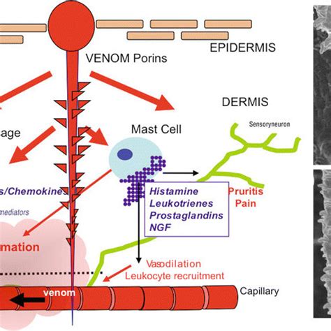 9.6 Representative ECG and ECHO recording of Chironex fleckeri venom... | Download Scientific ...