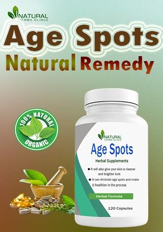 Try these Age Spots Natural Remedies to Recover Naturally