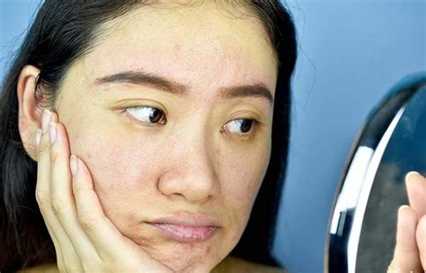 Sallow Skin: What Are The Causes? Can It Be Treated? | Sallow skin, Skin, Proper skin care routine