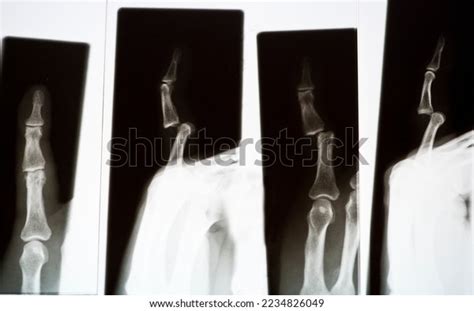 Radiography Fotos Human Body Stock Photo 2234826049 | Shutterstock