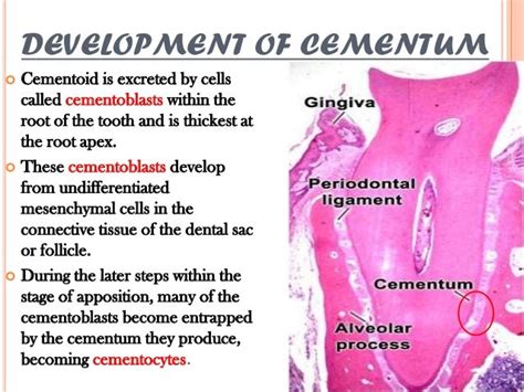 Cementum