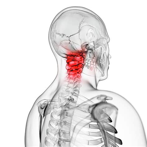 Anatomy Of The Neck Bones