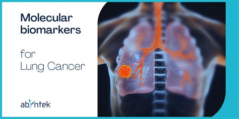 Molecular biomarkers for lung cancer - Abyntek Biopharma