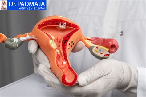 What Are Tubectomy And Tubectomy Reversal?