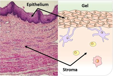 Structure of vaginal mucosa. Histology of the vaginal mucosa depicting... | Download Scientific ...