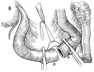 GI surgery 1