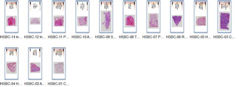 High-resolution scan copies of pathology slides, digital pathology slides