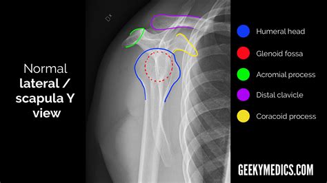 Shoulder X-ray Interpretation | Radiology | Geeky Medics