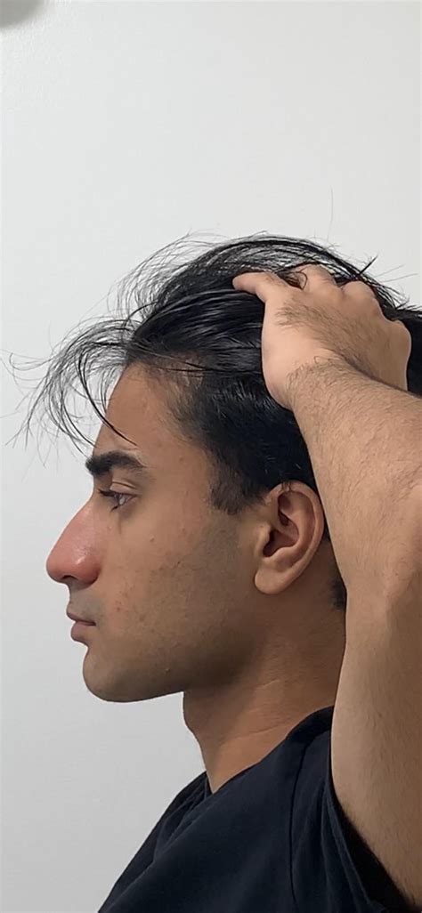 what is wrong with my side profile. i cant figure it out and how bad is ...