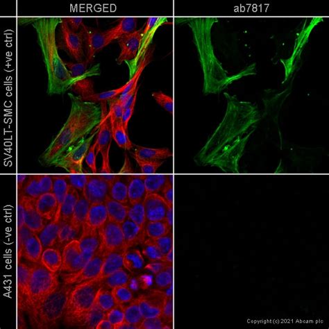 Anti-alpha smooth muscle Actin antibody [1A4] KO Tested (ab7817) | Abcam