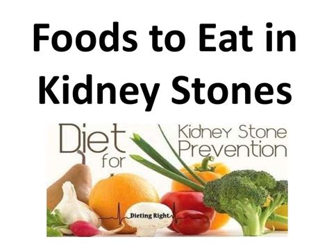 Safety Considerations For Renal Calculi Diet